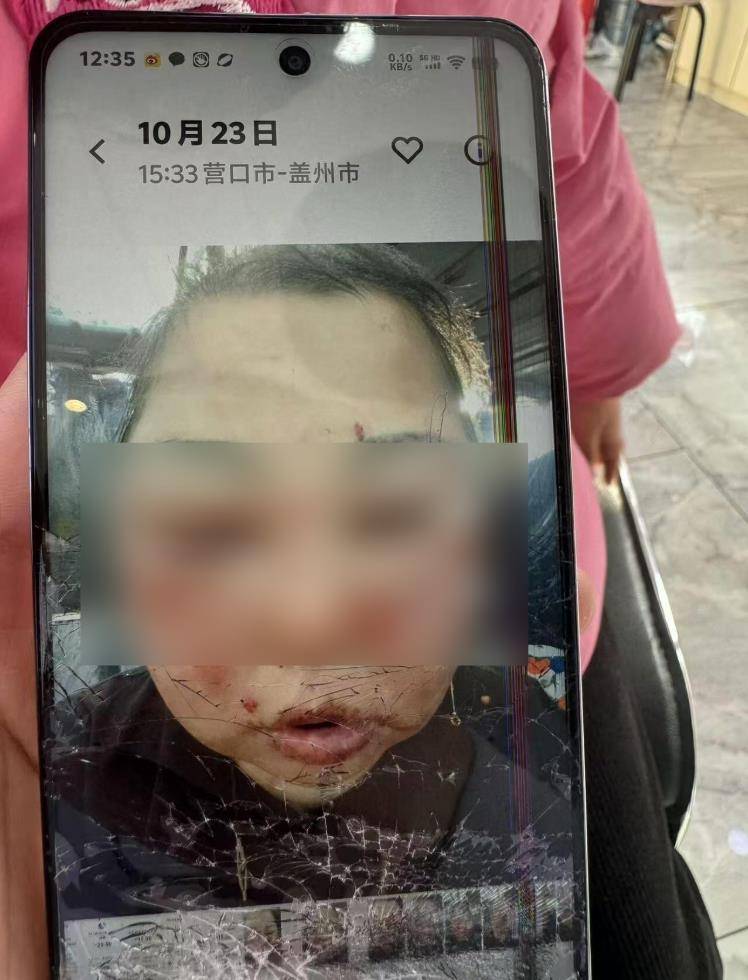 奥地利vs塞浦路斯_被前夫打进ICU的女子不幸身亡奥地利vs塞浦路斯,大女儿称正送母亲去殡仪馆,今后安排暂未考虑,希望严惩凶手