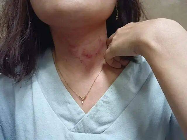 皇冠信用网正网
_一男子凌晨听到两声呼救皇冠信用网正网
，循声发现一女子在奔驰车外被白衣男勒昏！受害者：是受朋友之托借钱给白衣男，凌晨被骗至偏僻处遭非礼！