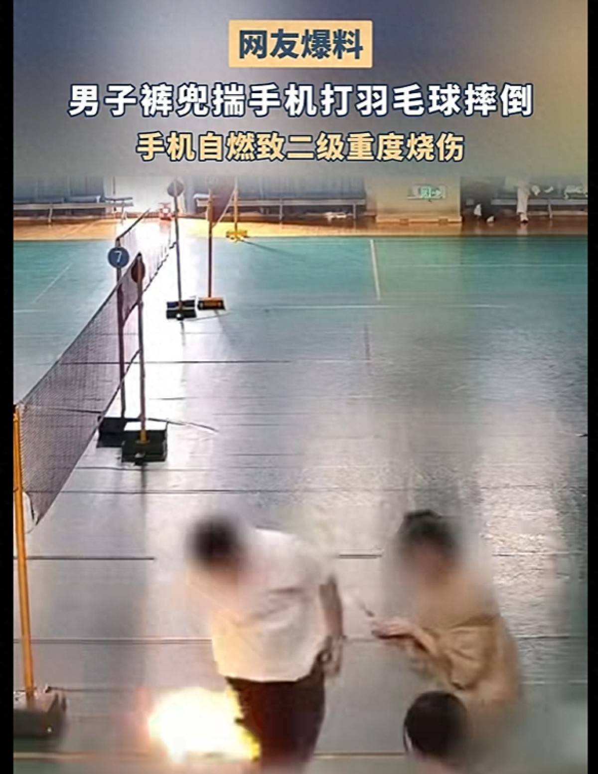 皇冠信用网代理申请_男子打羽毛球时不慎摔倒皇冠信用网代理申请，裤兜里的手机突然爆燃，造成男子二级重度烧伤！